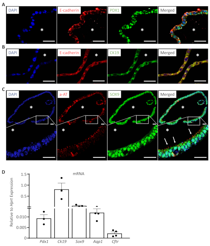 figure-results-3 Immunofluorescence for DAPI, E-cadherin, PDX1, CK19, a-AT, SOX9 in tissue; mRNA expression graph.