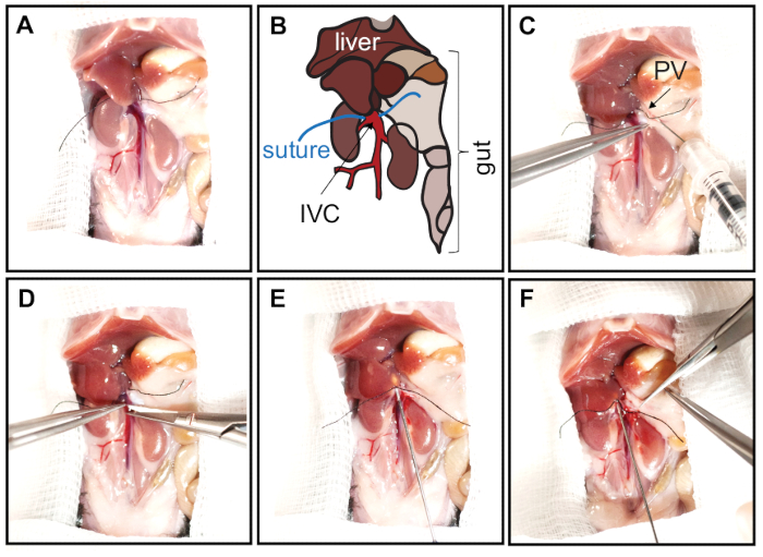 figure-results-2 Surgical procedure diagram and images illustrating liver and gut anatomy with suturing steps.
