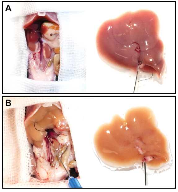 figure-results-3 Surgical liver extraction, comparison of two liver samples; hepatic tissue differences, research analysis.