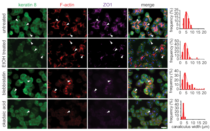 figure-results-5 Fluorescence microscopy of cell junctions; keratin 8, F-actin, ZO1 shown; bar charts display data.