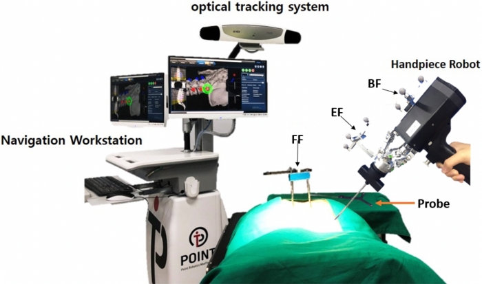 figure-results-3 Surgical navigation diagram with optical tracking and robotic handpiece for precise probe positioning.