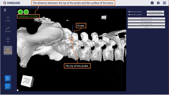 figure-results-6 Probe measurement in vertebrae model, 3D imaging, distance computation, surgical precision analysis.