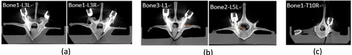 figure-results-8 CT scan diagram of vertebrae samples in static equilibrium experiment for biomechanical analysis.