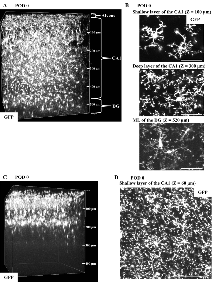 figure-results-2 Neuronal distribution diagram, GFP microscopy, brain sections, CA1, DG layers, POD 0 analysis.