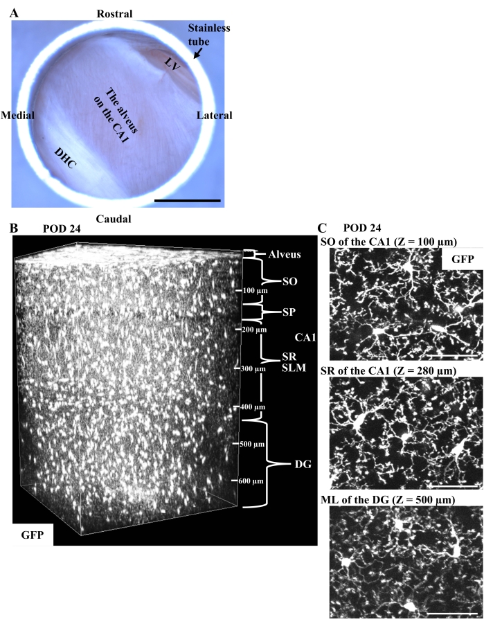 figure-results-3 Brain region analysis; hippocampus images; microscopy data; labeled GFP; neuroanatomical study.
