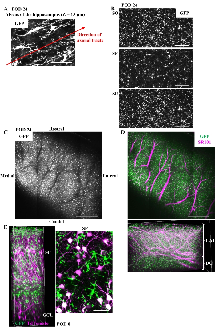 figure-results-4 Hippocampus axonal tracts with GFP, SR101 microscopy analysis, neural network imaging.