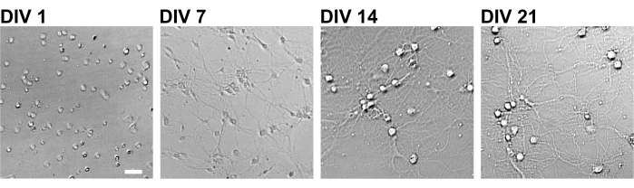 figure-results-2 Neuronal cell culture, DIV 1-21, growth progression, phase contrast microscopy, developmental stages.