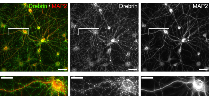 figure-results-3 Neuronal structure microscopy; drebrin, MAP2 proteins; fluorescence images; cellular organization.