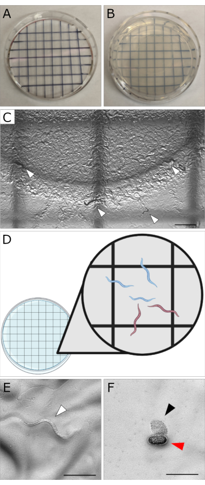 figure-results-1 Petri dish membrane filter experiment with grid analysis for microorganism growth, microscopy results.