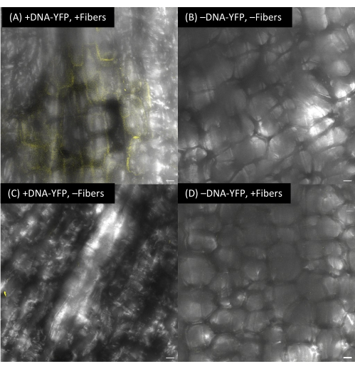 figure-results-14 Fluorescence microscopy showing DNA-YFP with/without fibers; cellular structure visualization.