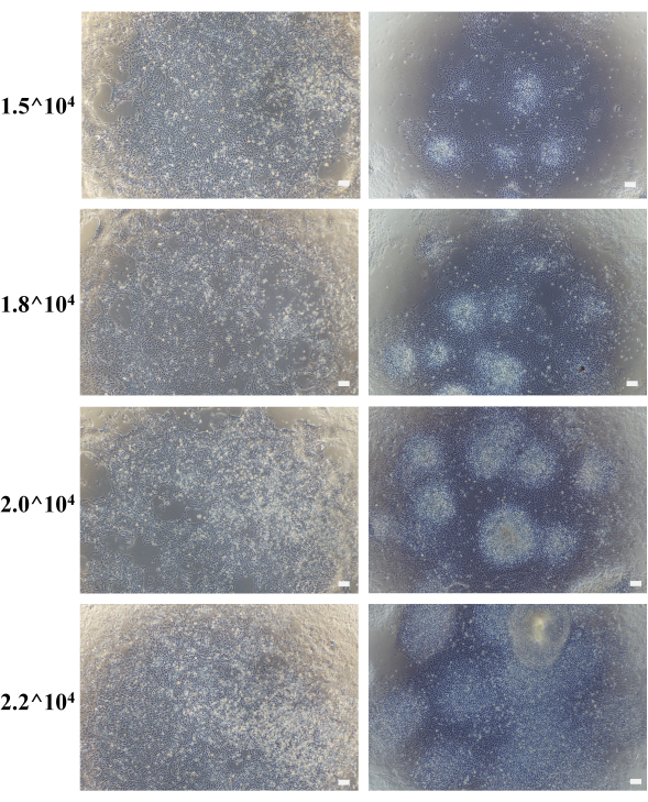 figure-results-4 Cell culture density, microscopy images, different seeding densities from 1.5^4 to 2.2^4, comparative analysis.