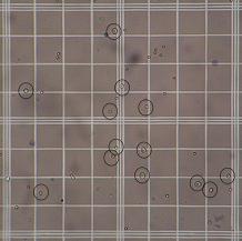 figure-protocol-1 Cell counting grid microscopy image; hemocytometer use for cell density and viability assessment.
